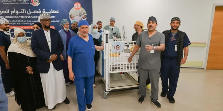 نجاح فصل التوأم الملتصق الصومالي “رحمة و رملا” بعد عملية جراحية معقدة استغرقت 12 ساعة